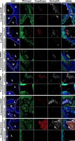 Rabbit IgG (H+L) Highly Cross-Adsorbed Secondary Antibody in Immunohistochemistry (Paraffin) (IHC (P))