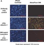 Goat IgG (H+L) Cross-Adsorbed Secondary Antibody in Immunocytochemistry (ICC/IF)