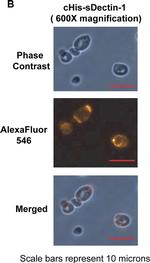 Goat IgG (H+L) Cross-Adsorbed Secondary Antibody in Immunocytochemistry (ICC/IF)