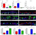 FOXJ1 Antibody in Immunohistochemistry (Frozen), Immunocytochemistry (IHC (F), ICC/IF)