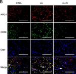Mouse IgG (H+L) Highly Cross-Adsorbed Secondary Antibody in Immunocytochemistry (ICC/IF)