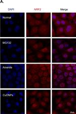Rabbit IgG (H+L) Highly Cross-Adsorbed Secondary Antibody in Immunocytochemistry (ICC/IF)