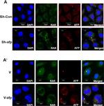 Rabbit IgG (H+L) Cross-Adsorbed Secondary Antibody in Immunocytochemistry (ICC/IF)