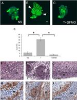 E-cadherin Antibody in Immunohistochemistry (IHC)