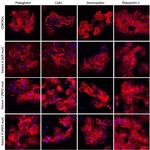 PKP1 Antibody in Immunocytochemistry (ICC/IF)