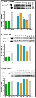 RhoA Antibody in Western Blot (WB)