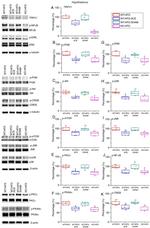 Phospho-AKT1 (Ser473) Antibody in Western Blot (WB)