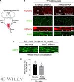 Ankyrin G Antibody in Immunohistochemistry (PFA fixed) (IHC (PFA))