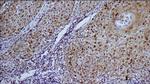 ERCC1 Antibody in Immunohistochemistry (IHC)