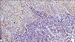 ERCC1 Antibody in Immunohistochemistry (IHC)
