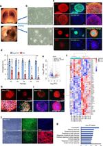 Cytokeratin 5 Antibody in Immunocytochemistry (ICC/IF)