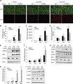 KSHV ORF45 Antibody in Western Blot (WB)