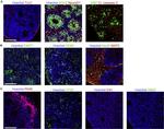 OTX2 Antibody in Immunohistochemistry (IHC)