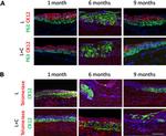 TERT Antibody in Immunohistochemistry (IHC)