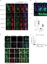 SARS/SARS-CoV-2 Nucleocapsid Antibody in Immunocytochemistry (ICC/IF)