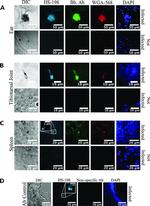 Borrelia burgdorferi Polyclonal Antibody, FITC