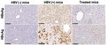 Hepatitis B Virus Surface Ad/Ay Polyclonal Antibody, Biotin
