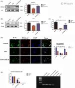 IL4I1 Antibody in Western Blot, Immunocytochemistry (WB, ICC/IF)