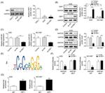 AKR1B1 Antibody in Western Blot (WB)