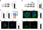 Lass5 Antibody in Western Blot (WB)