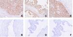 FOXC2 Antibody in Immunohistochemistry (Paraffin) (IHC (P))