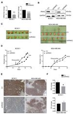 Cyclin D1 Antibody in Immunohistochemistry (IHC)