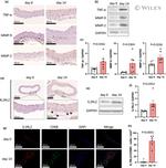 IL1RL2 Antibody in Western Blot, Immunohistochemistry (WB, IHC)