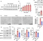 IL1RL2 Antibody in Western Blot (WB)