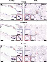 GPNMB Antibody in Immunohistochemistry, Immunohistochemistry (Paraffin) (IHC, IHC (P))
