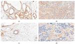 RBMS3 Antibody in Immunohistochemistry (Paraffin) (IHC (P))