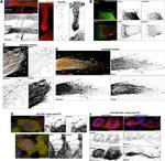 TMEM8C Antibody in Immunocytochemistry (ICC/IF)