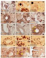 IYD Antibody in Immunohistochemistry (IHC)