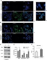 Phospho-PKM2 (Ser37) Antibody in Immunocytochemistry (ICC/IF)