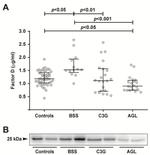 Factor D Antibody in Western Blot (WB)