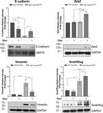 ZEB2 Antibody in Western Blot (WB)