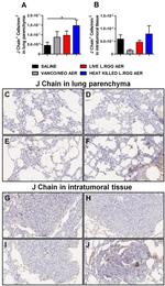 J Chain Antibody in Immunohistochemistry (Paraffin) (IHC (P))