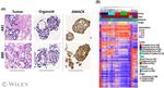 AMACR Antibody in Immunohistochemistry (IHC)