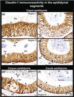 Claudin 1 Antibody in Immunohistochemistry (Paraffin) (IHC (P))