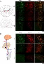 PDE5 Antibody in Immunohistochemistry (Frozen) (IHC (F))