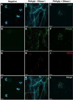 Complement C5b Monoclonal Antibody (aE11)