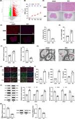 PRMT8 Antibody in Western Blot (WB)