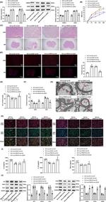 PRMT8 Antibody in Western Blot (WB)