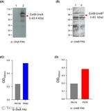 Helicobacter pylori Urease B Antibody in ELISA (ELISA)