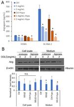 Angiogenin Antibody in Western Blot (WB)
