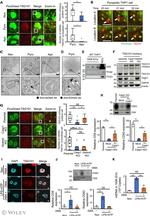 CD9 Monoclonal Antibody (MM2/57)