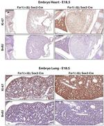 Ki-67 Antibody in Immunohistochemistry (IHC)