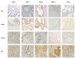TIMP3 Antibody in Immunohistochemistry (Paraffin) (IHC (P))