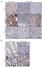 AGXT Antibody in Immunohistochemistry (Paraffin) (IHC (P))