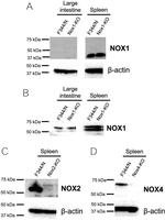 NOX1 Antibody in Western Blot (WB)