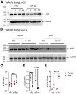 ACE2 Antibody in Western Blot (WB)